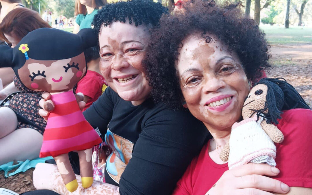 Segundo Encontro de Pessoas com Vitiligo convoca comunidade com diferenças de pele em SP